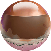 Orb 4